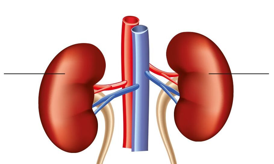 Hipertensión renal renal